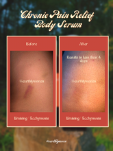 Load image into Gallery viewer, Chronic Pain Relief Body Serum
