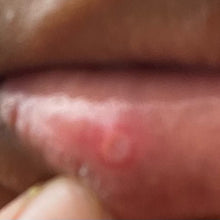 Load image into Gallery viewer, Cold Sore Lip Salve