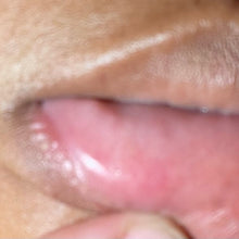 Load image into Gallery viewer, Cold Sore Lip Salve