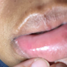 Load image into Gallery viewer, Cold Sore Lip Salve