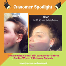 Load image into Gallery viewer, Hibiscus Lover Serum & Butter Balm Kit