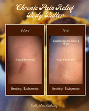 Load image into Gallery viewer, Chronic Pain Relief Body Butter